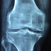 hand-trunk-old-leg-human-care-619689-pxhere.com